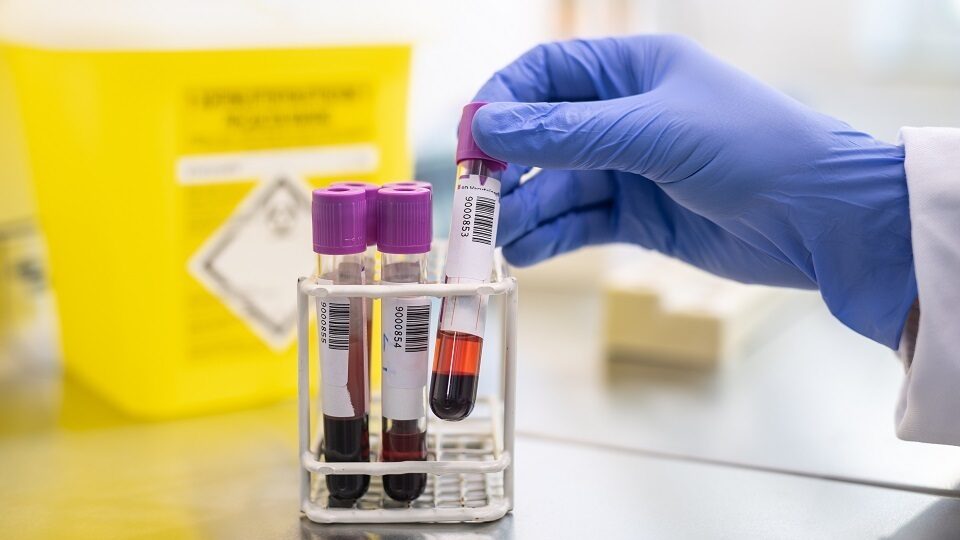 Анализы для взрослых