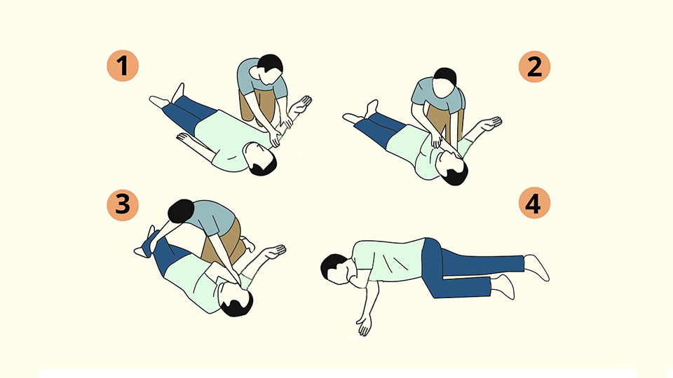 Сердечно-легочная реанимация